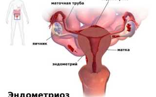 Пришли месячные со слизью — что это значит, стоит ли бить тревогу?