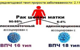 ВПЧ 16 типа у женщин — причины возникновения, симптомы, диагностика, проявления и медикаменты для лечения