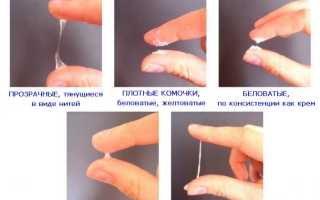 Какие выделения можно считать нормой у здоровой женщины