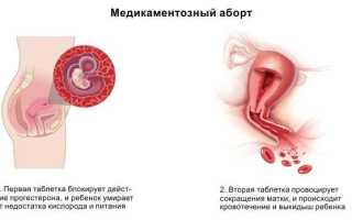 Вакуумная чистка матки: проведение процедуры, последствия, отзывы