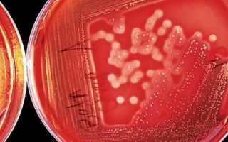 Ureaplasma urealyticum: характеристика, анализы, симптомы у женщин и мужчин, лечение