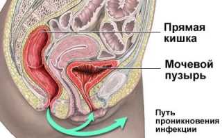 Причины цистита во время и перед месячными каждый месяц