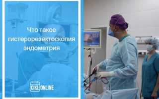 Какие выделения и сколько длятся после удаления (гистероскопии) полипа в шейке матки
