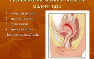 Загиб матки кпереди (антефлексия): причины, лечение состояния