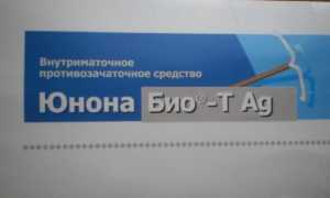 Спираль Юнона Био-Т с серебром внутриматочная: инструкция, отзывы