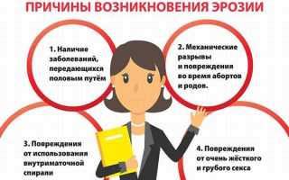Опасна ли эрозия шейки матки и каких последствий ожидать при отсутствии лечения
