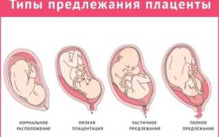 Признаки имплантации после овуляции (ДО задержки!)