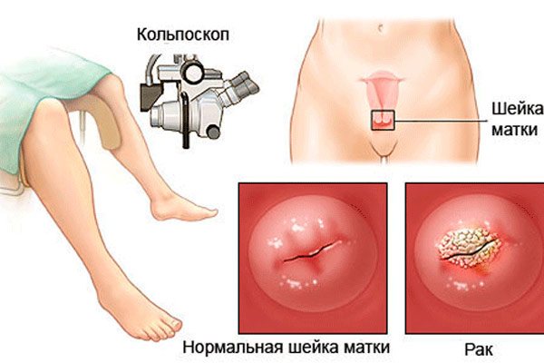 локализация опухоли