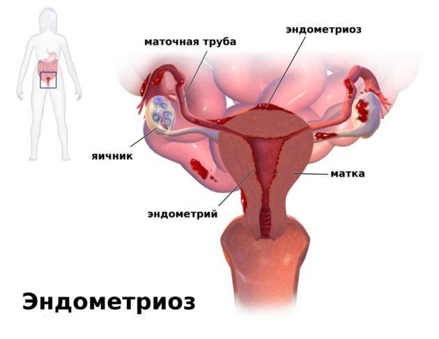 Месячные со слизью прозрачной 3