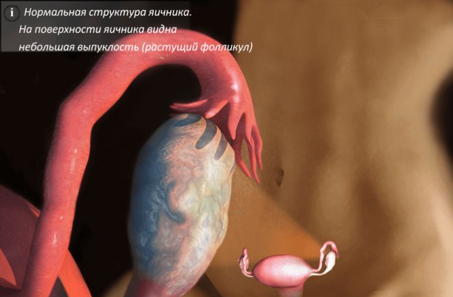 Нормальная структура яичника
