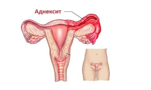 опасность кандидоза