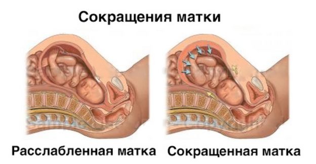Твердая матка при беременности 1