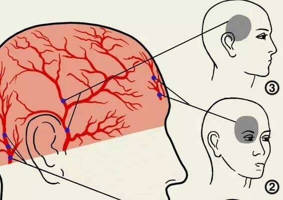 Болит глаз и голова причины