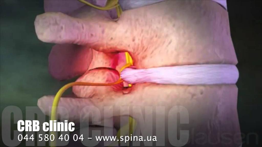 часто болит спина в низу