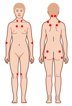 При сердечных болях болит спина