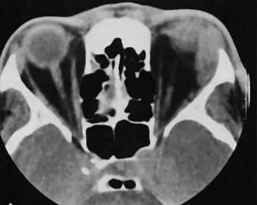Когда болит спина и температура воды