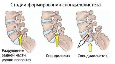 Болит спина и ноги ночью