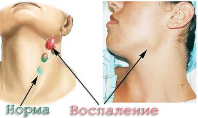 Когда болит спина и температура воды