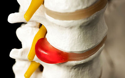 Болит спина и ноги ночью