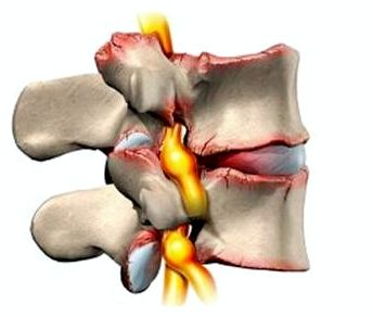 болит спина ребра тяжело дышать