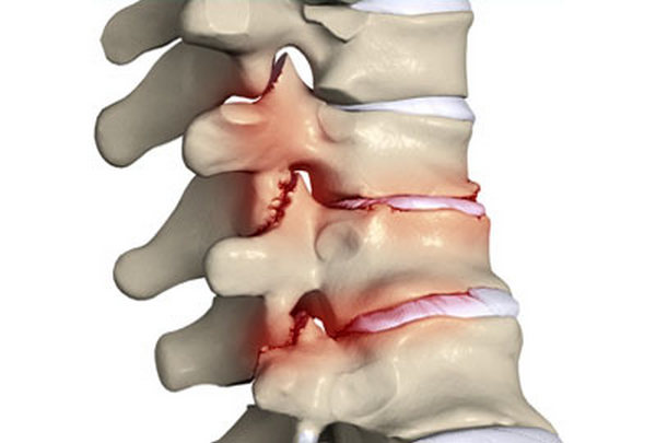 Болит спина чуть выше поясницы с одной стороны