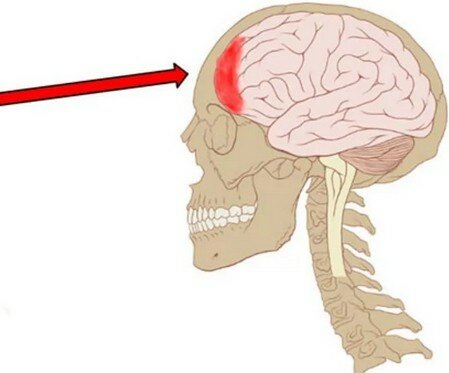 Ужасно болит лобная часть головы