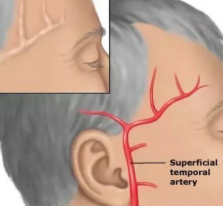 Болит правая сторона головы правый висок