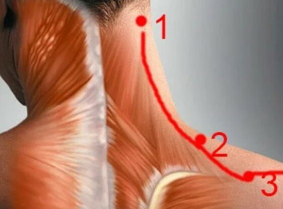 Болит голова и шея сзади к какому врачу обратиться