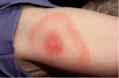 Сильно болит голова если слабость