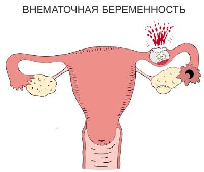 Середина цикла болит спина