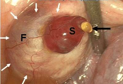 Середина цикла болит спина