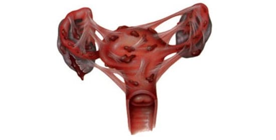 Середина цикла болит спина