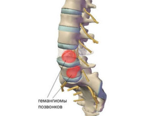 Почему болит спина справа при вдохе