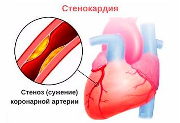 Почему болит спина справа при вдохе