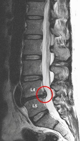 Болит спина справа лечение