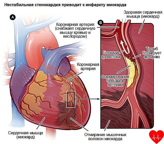 Болит спина справа лечение