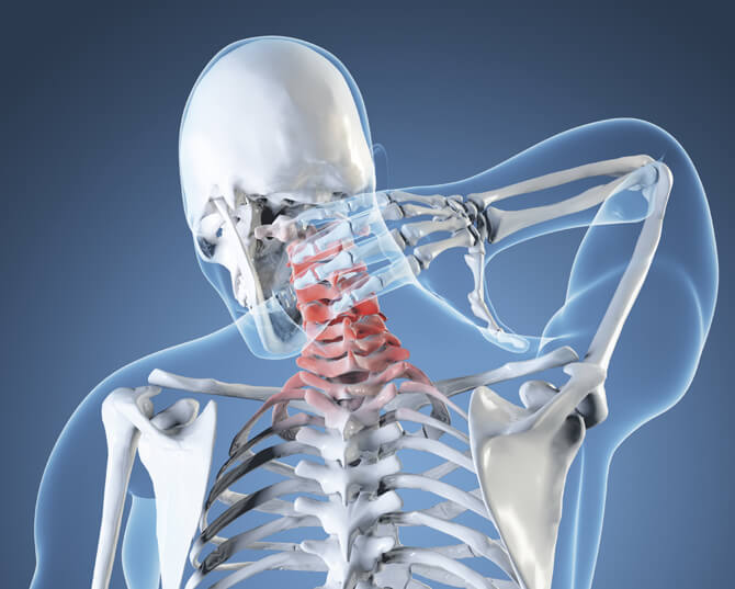 meditsina-osteohondroz-i-golovnye-boli