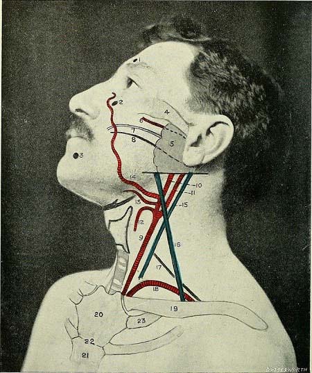 локализация проблемы есть нарушения