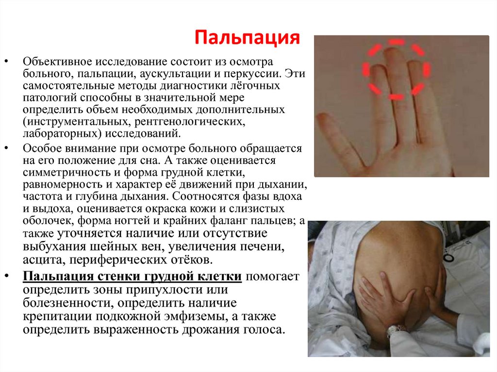 Определение пальпации