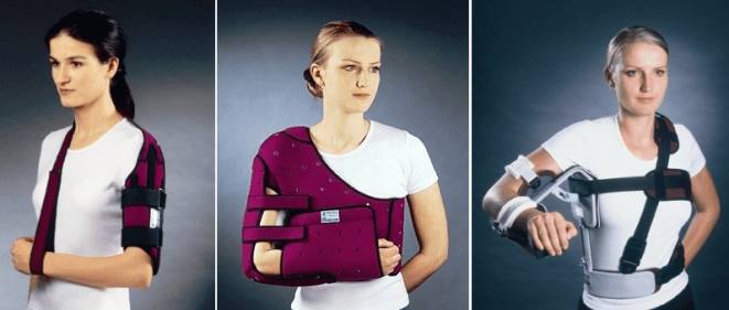 perelom-shejki-plecha (1)