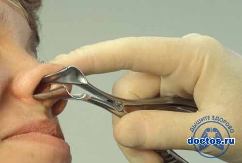 Риноскопия