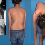 Сильно болит в грудине и отдает в спину