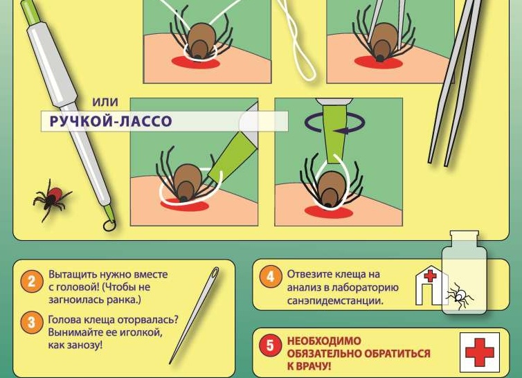 Первая помощь при укусе клеща: ваше действие может спасти здоровье