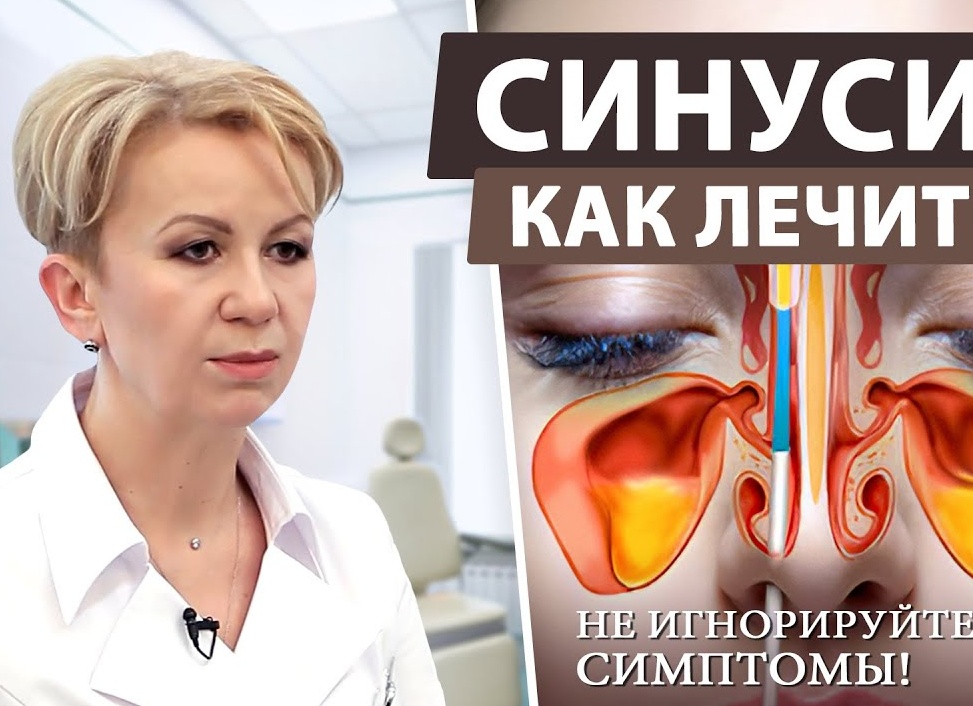 Гайморит: симптомы и методы лечения