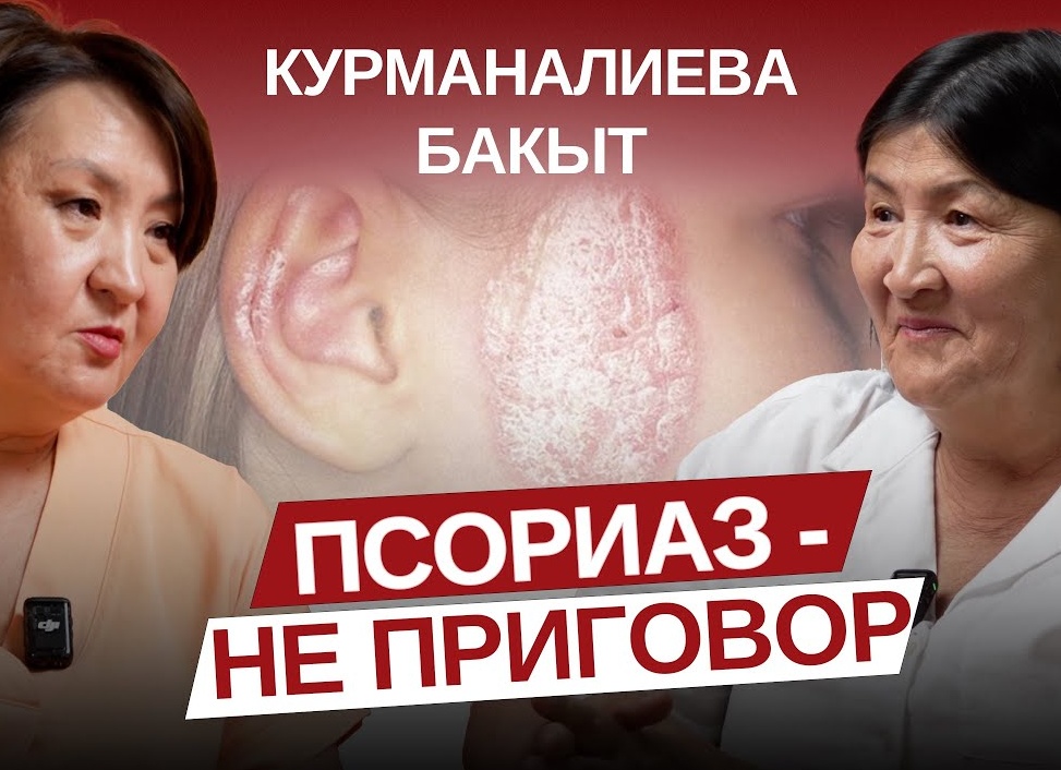 Псориаз – не приговор: как взять болезнь под контроль и забыть об обострениях